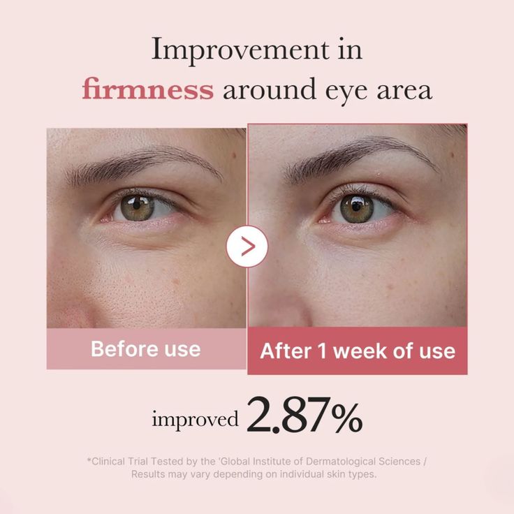 PDRN Pink Peptide Eye Cream